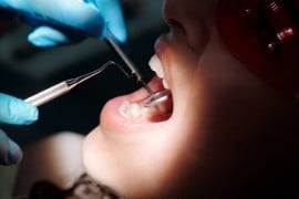 Problemi dentali: quali sono i più comuni?