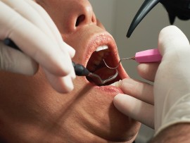 Igiene Orale a casa o dal dentista?