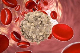 Leucemia linfatica cronica: i dati dello studio Glow dimostrano i benefici della terapia di combinazione con Ibrutinib a durata fissa