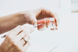 Conviene riparare la dentiera?
