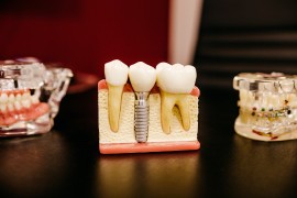 Quali sono le differenze tra dentista ed ortondontista